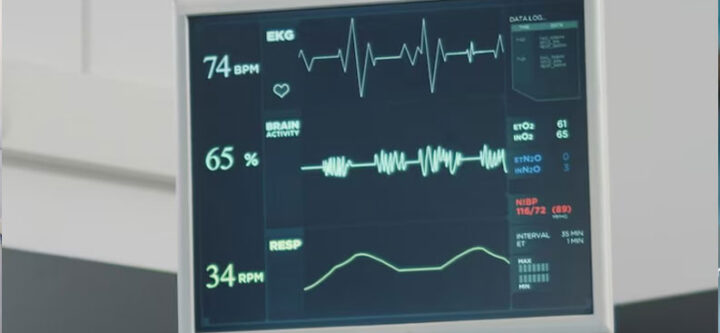 monitor